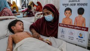 बंगलादेशमा फैलिएको दादुराले ५१२ बालबालिकाको मृत्यु